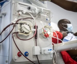 North-west not excluded from kidney dialysis subsidy -FG
