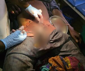 Borno man st@bs self and removes his p3nis after estranged wife refused to return home