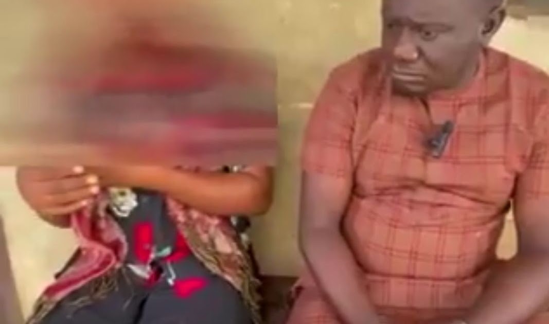 VIDEO: NYSC Corps Member Details Traumatic Assault, Abduction by Anambra Vigilantes