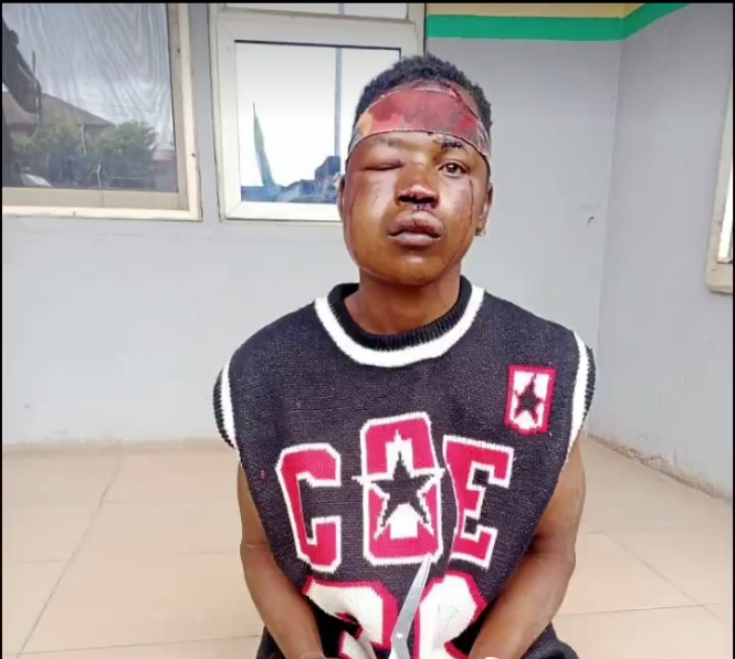 Vandal beaten to pulp after injuring witness in Lagos