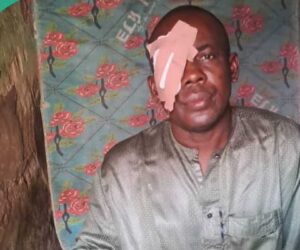 Nigerian Man Cries Out For N2m For Cancer Surgery, “I Cannot Afford It”