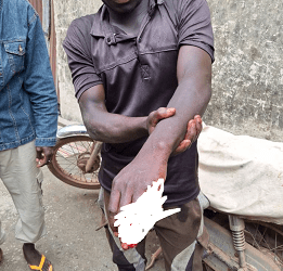 Two men arraigned for assaulting man in Ondo