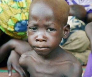 Enugu commends UNICEF for technical, moral support in eradicating malnutrition