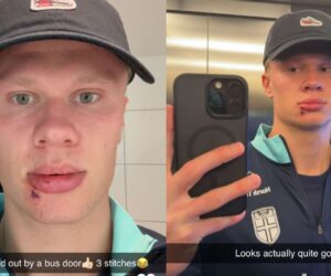 Erling Haaland requires stitches after Norway ‘bus door’ incident