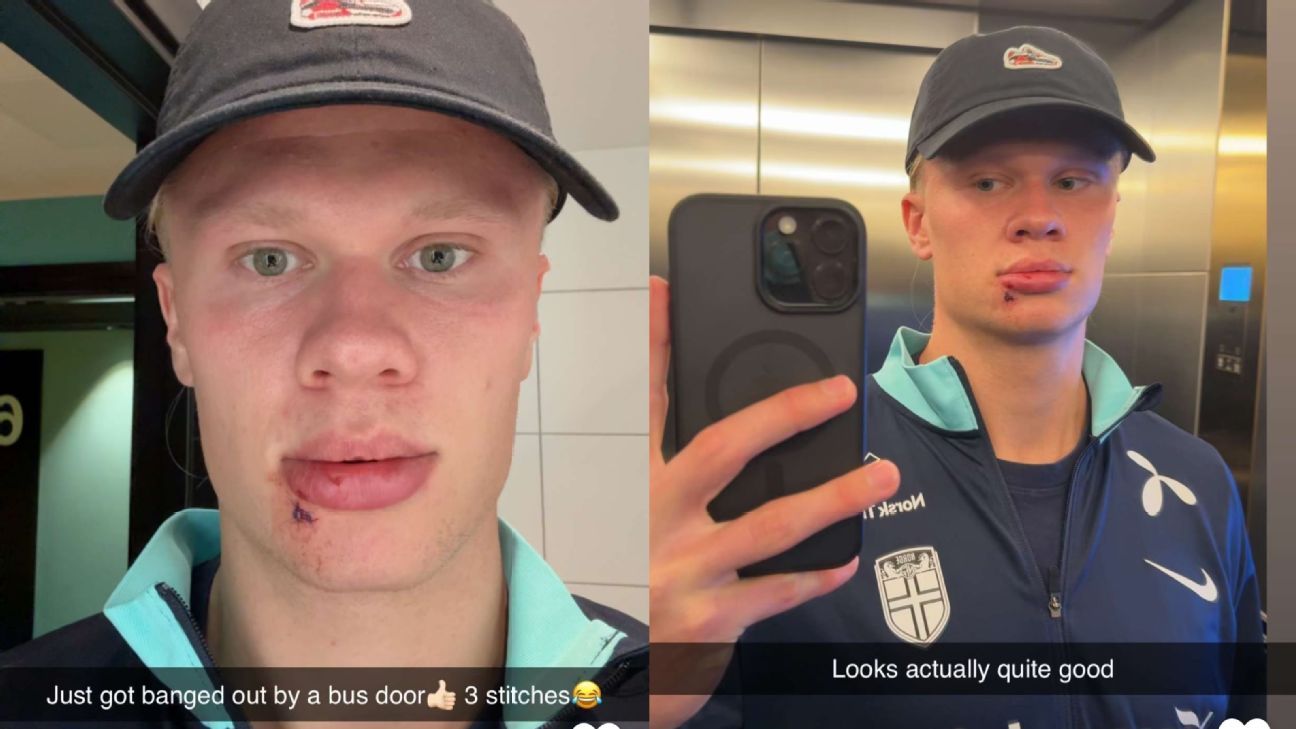 Erling Haaland requires stitches after Norway ‘bus door’ incident