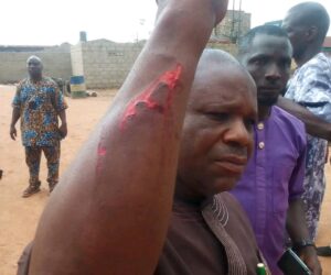 BREAKING: Three Hospitalised After Suspected APC Thugs Attack ADC Meeting In Ondo
