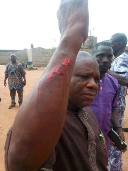 BREAKING: Three Hospitalised After Suspected APC Thugs Attack ADC Meeting In Ondo