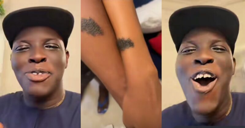 Man shocked to discover his friend and girlfriend have same birthmark
