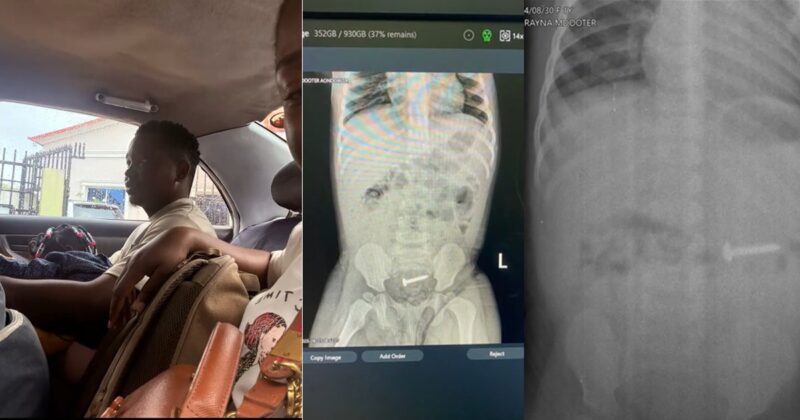 Woman shares how her daughter swallowed a nail but fortunately excreted it without surgery (WATCH)