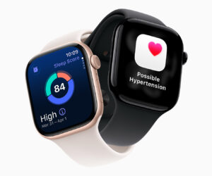 Some key Apple Watch Series 11 features are coming to older watches – will yours get the update?