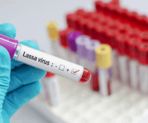 Nigeria’s virology institute joins global search for Lassa fever vaccine