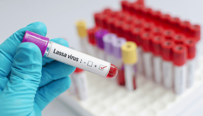 Nigeria’s virology institute joins global search for Lassa fever vaccine