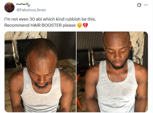 I’m not even 30 – Nigerian man laments premature balding