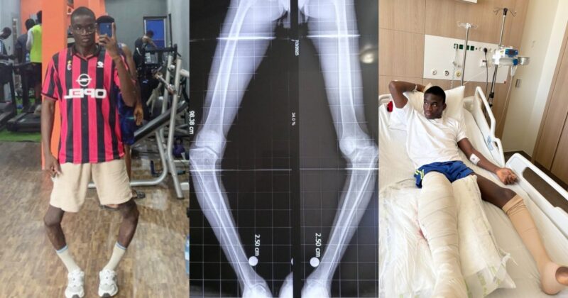 Complications arise as influencer undergoes successful first-stage surgery