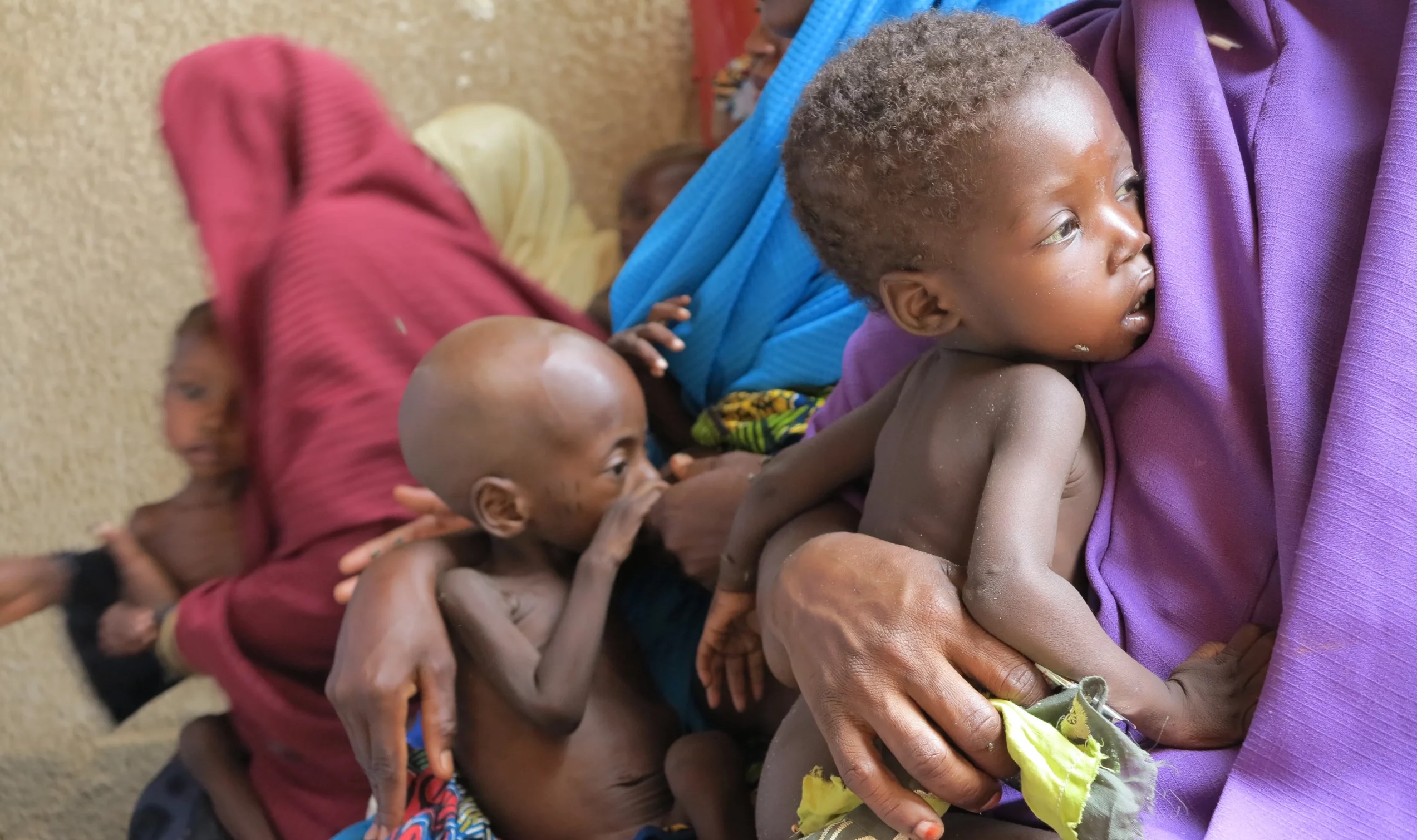 Jigawa dedicates 1% of annual budget to nutrition for 2026, subsequent years