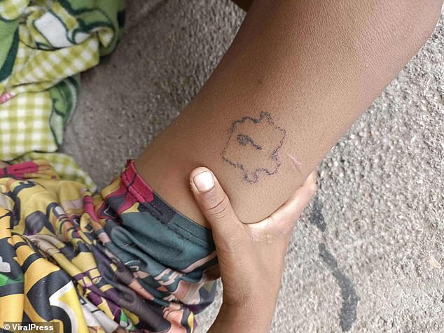 Bullies tattoo ‘p***y’ across ten-year-old boy’s forehead (Photos)