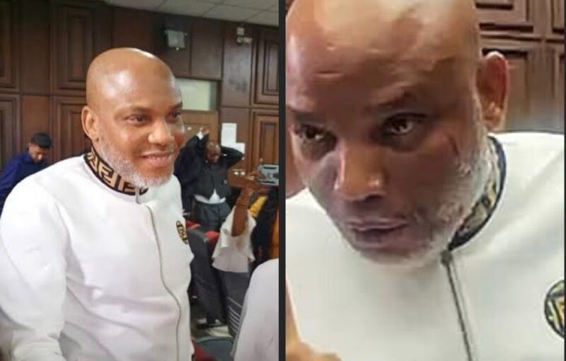 Nnamdi Kanu will Regain Freedom Without Opposition Antics – Ikonne