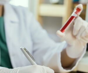 Scientists develop new blood test that detects over 50 types of cancer early
