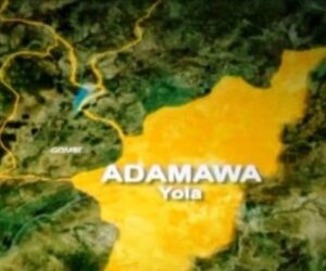 Adamawa Releases N300m To Tackle Malnutrition