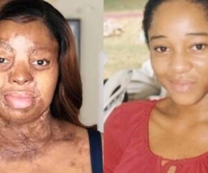 Sosoliso crash survivor Kechi Okwuchi celebrates 36th birthday with gratitude