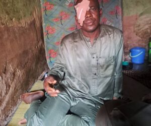 Cancer patient seeks ₦2m assistance for treatment – Daily Trust