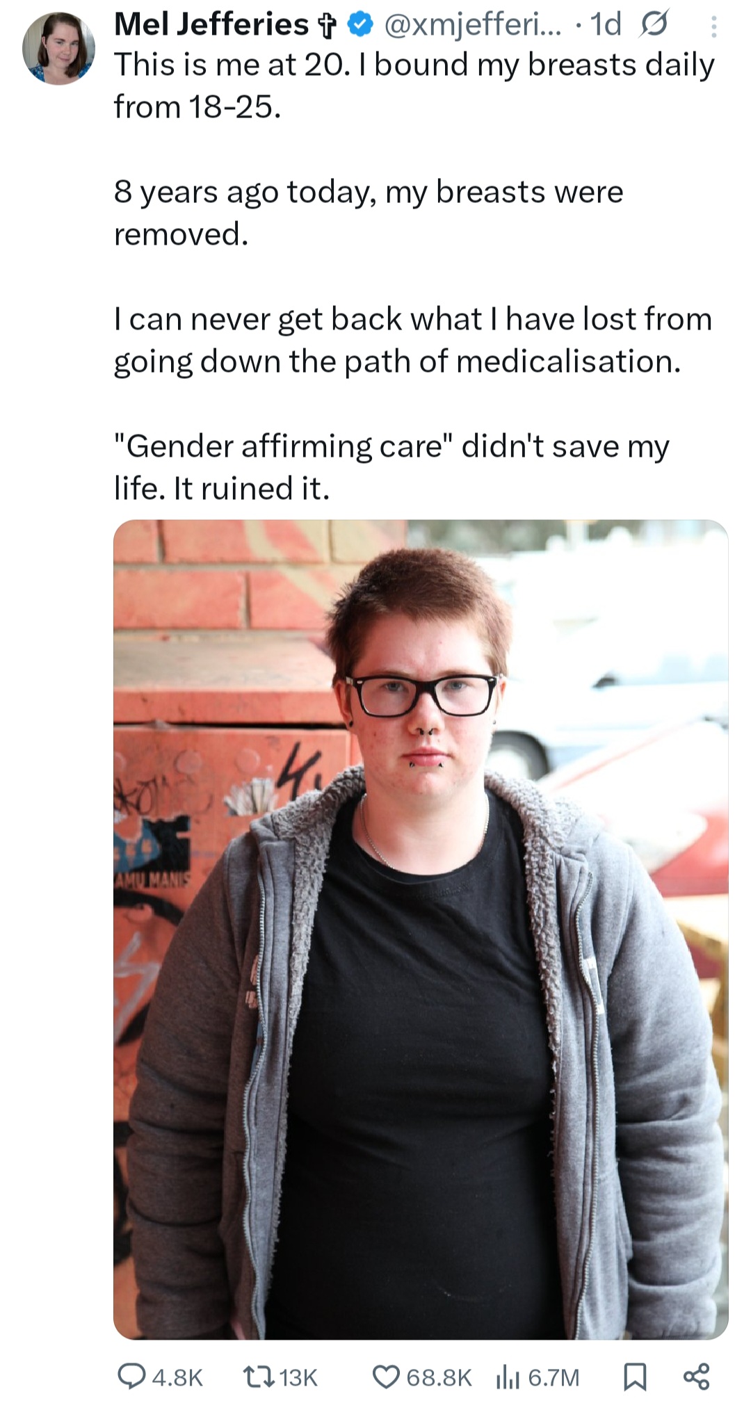 Woman who transitioned to a man says it “ruined” her life