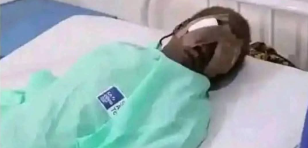 Teenage boy plucks out his 7-year-old sister’s eyes for money ritual in Bauchi