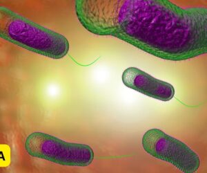 Cholera Claims 13 Lives In Adamawa