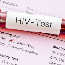 NCH Approves Reduction Of Age Of Consent For HIV Testing To 14 Years