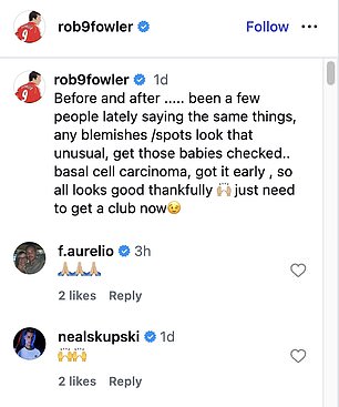 Liverpool legend, Robbie Fowler reveals he has undergone surgery to remove skin cancer from his face