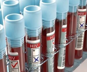 3.3m Could Contract HIV By 2030 – UNFPA