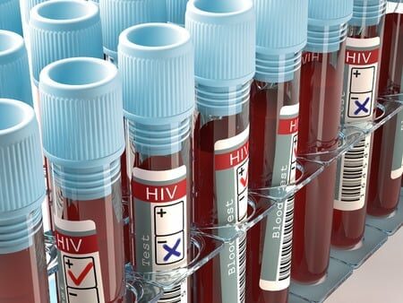 3.3m Could Contract HIV By 2030 – UNFPA