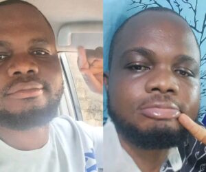 “I burst cry” – Doctor cries out over tax deduction from his salary next year