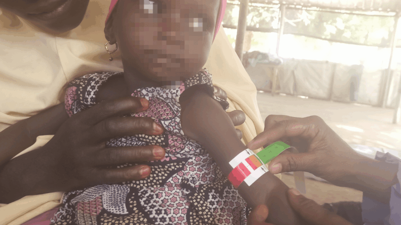 Inside Katsina’s child malnutrition crisis