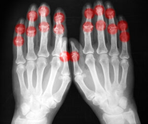 Radiography expert warns of manpower crisis as demand surges