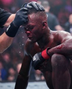 Adesanya vows to fight on after fourth loss – “I’m not f*cking leaving”