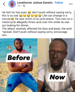 “Life can change in a minute” – Man loses both eyes after alleged acid attack